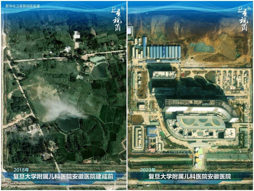 2023年與2018年相比，復(fù)旦大學(xué)附屬兒科醫(yī)院安徽醫(yī)院從一片荒地到建成投用。該項(xiàng)目是安徽省在長三角一體化高質(zhì)量發(fā)展衛(wèi)生健康領(lǐng)域的重大項(xiàng)目，也是安徽首批落地的國家區(qū)域醫(yī)療中心。